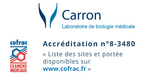 Carron-cofrac